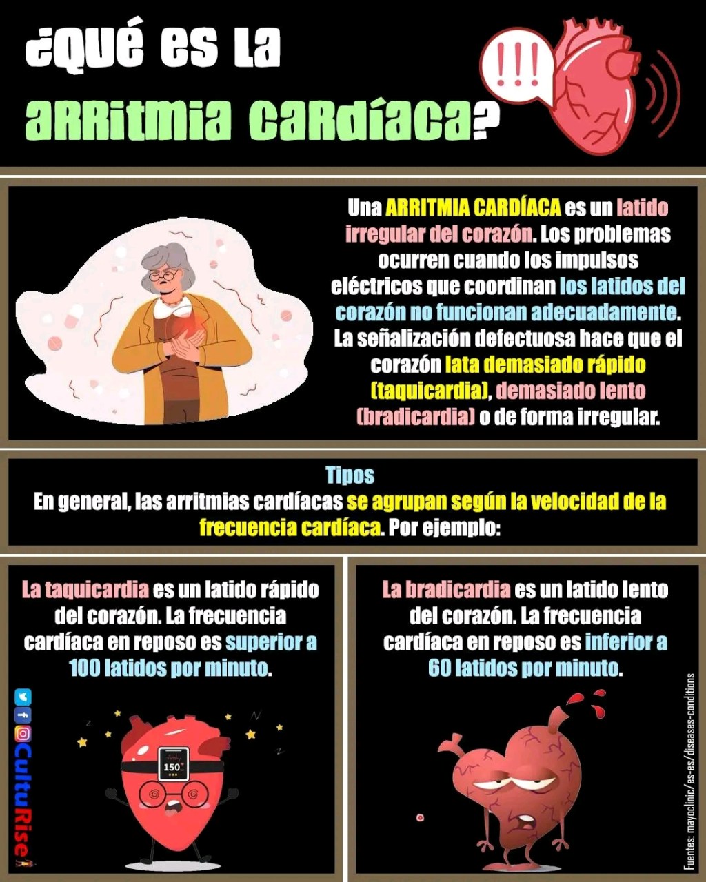 ¿Qué es la arritmia&nbsp;cardíaca?.
